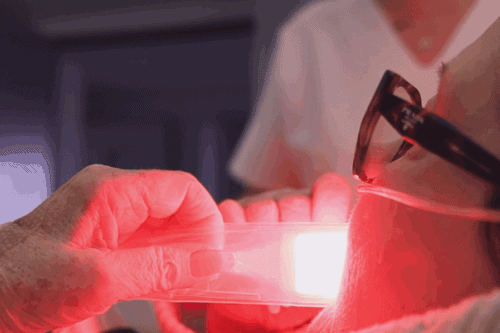 [VIDEO] Comment la photobiomodulation améliore la prise en charge et la qualité de vie des patients atteints de cancer